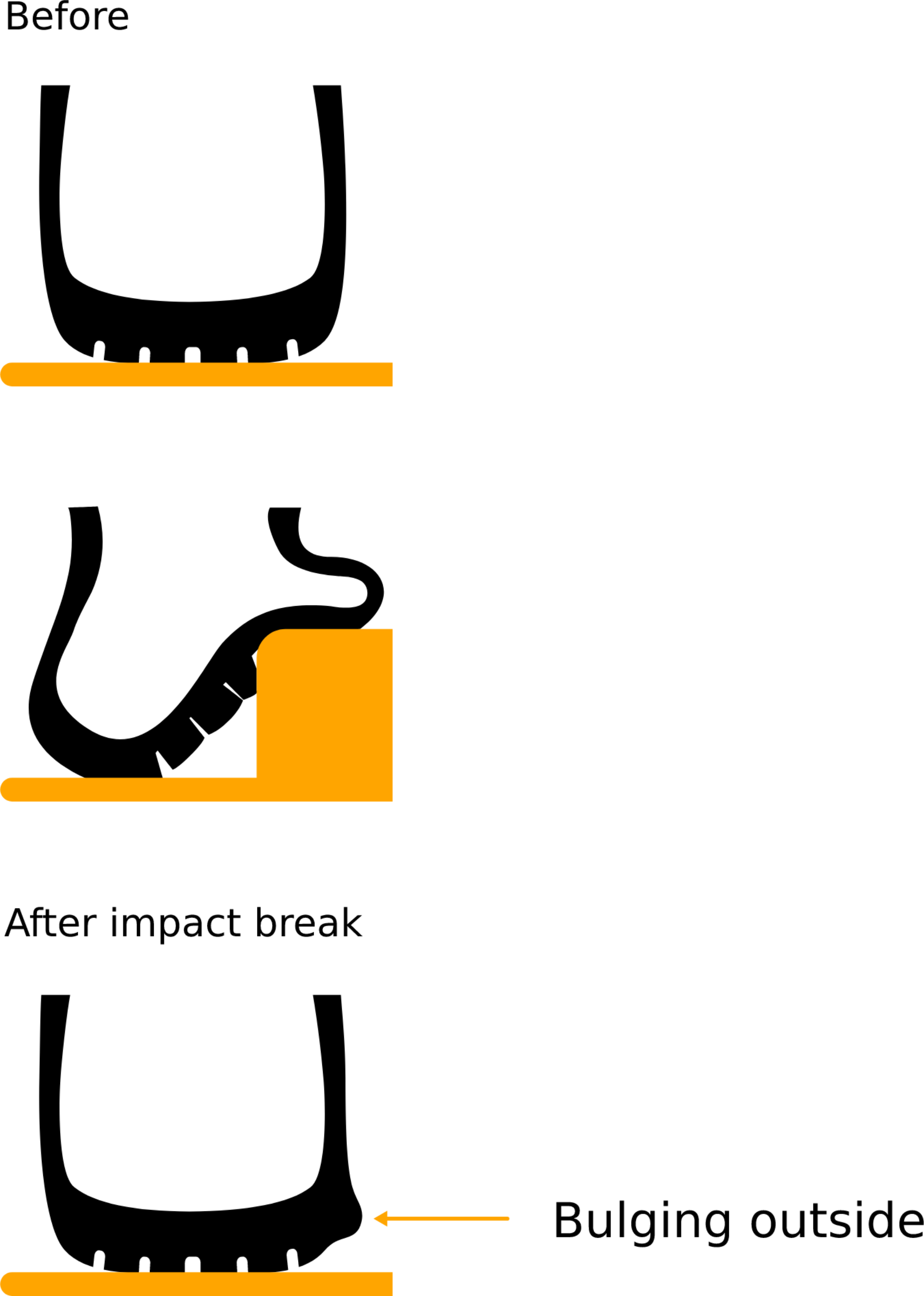 Impact breaks or bulges can occur from and impact.